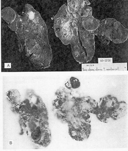 Thyroid Area